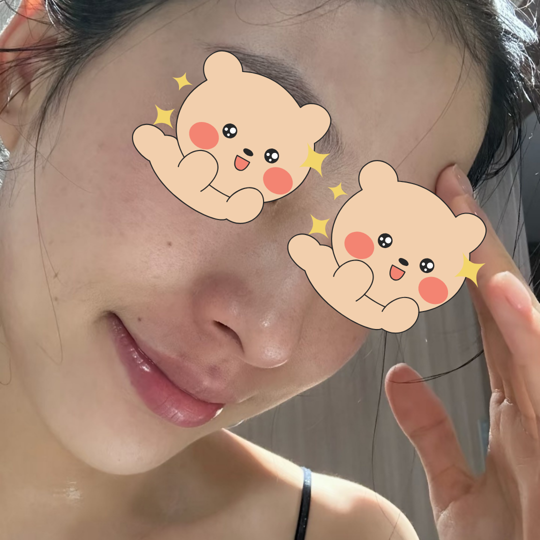 리투오 처음받아봤는데 이건 찐으로 효과있음..