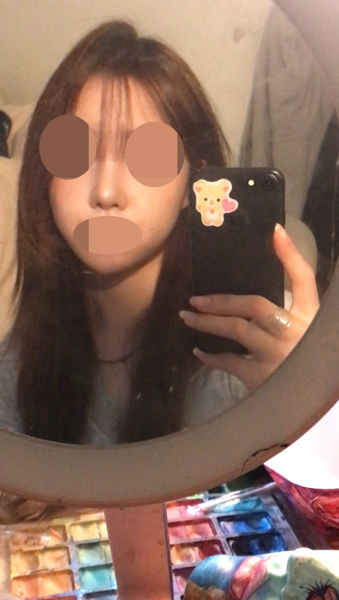 붓기 빠지면서 자연스럽게 이뻐지고 있어요!