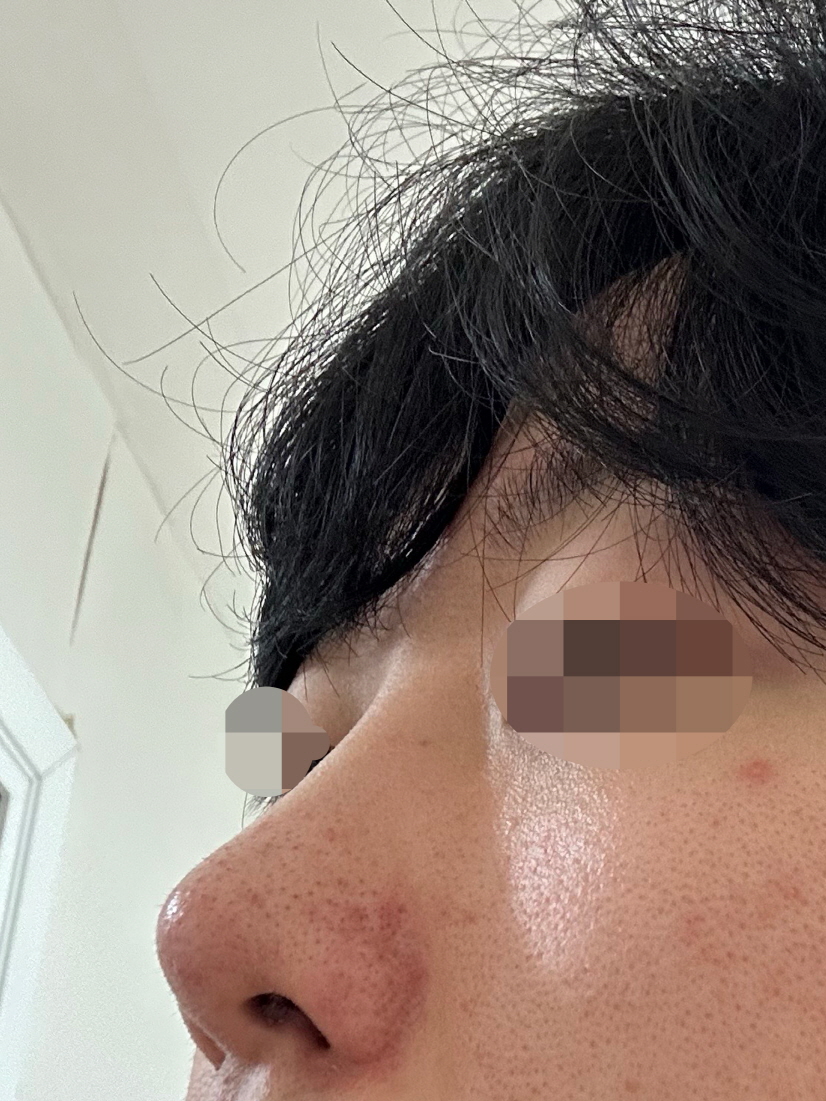 잘 회복하고 만족하면서 지내고 있습니다!