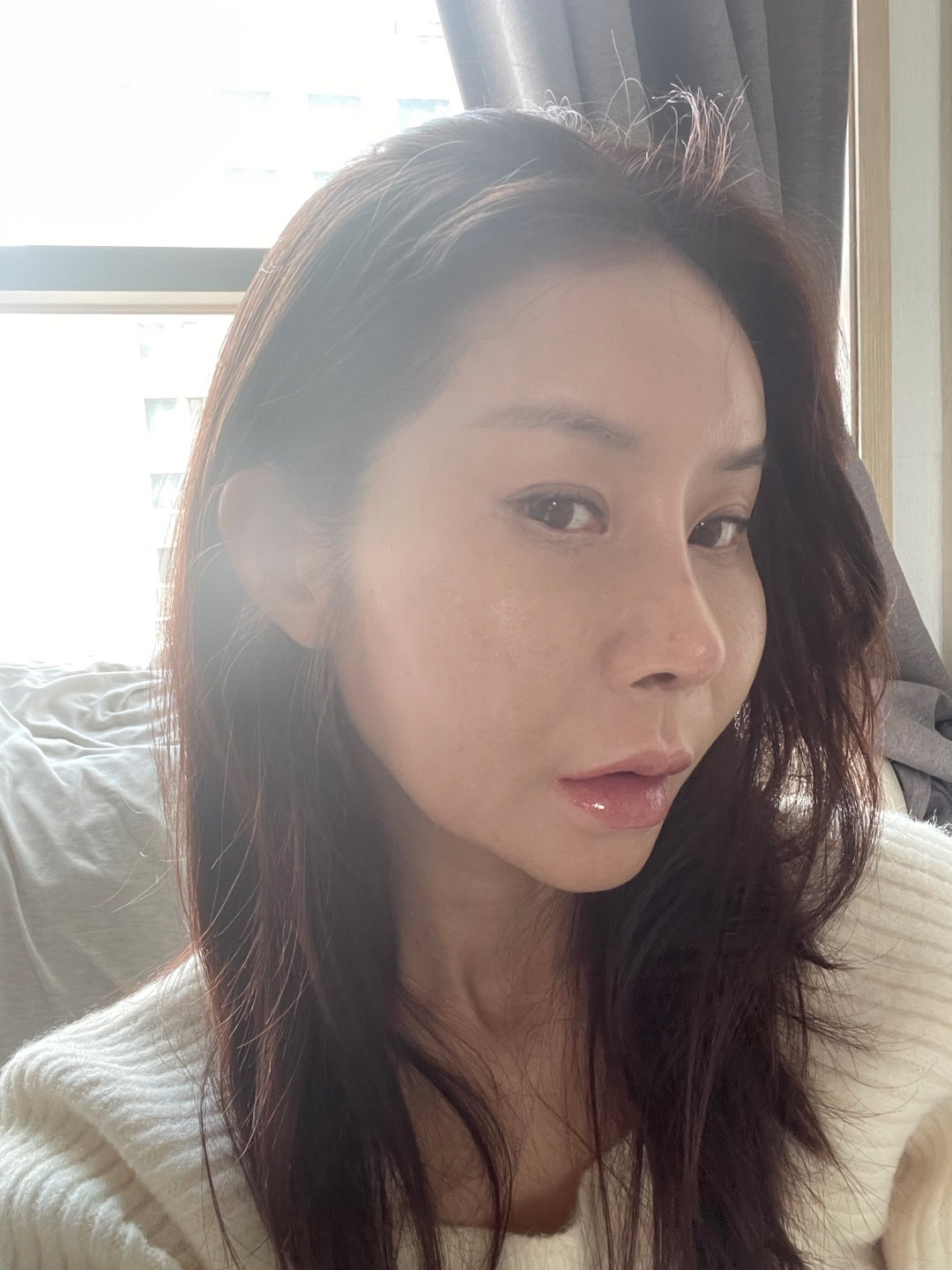 전혀 붓기나 멍이 없이 만족합니다. 피부 한계가 있어서 과하지않고 자연스럽게 된 것 같아요.