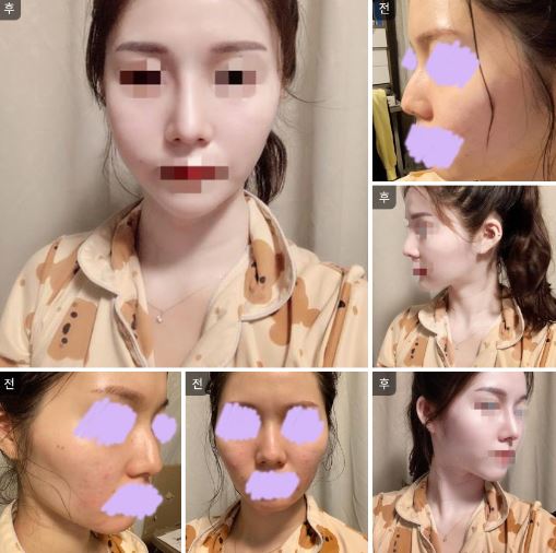 헤헷 미모업했습니당
