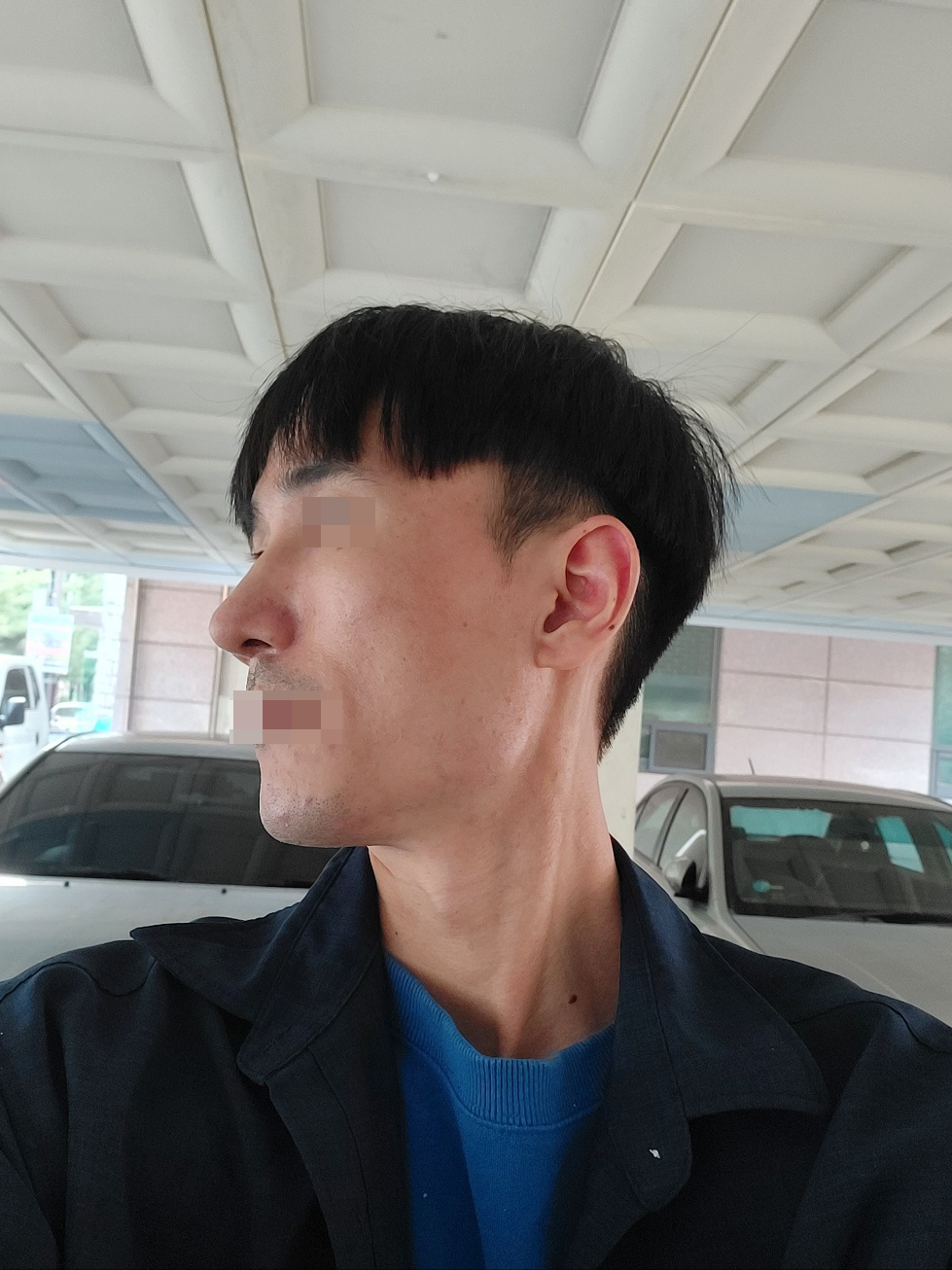 수술후 만족도가 높습니다