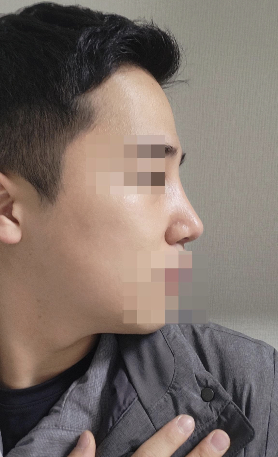 자연스럽게 라인 잘 만들어주셔서 코 예쁘다는 소리 자주 듣네요~~