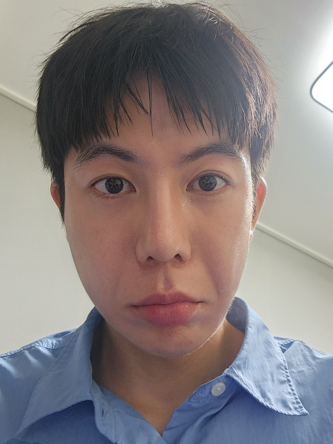 붓기만 싹 빠지면 진짜 대만족합니다 ㅎㅎ
