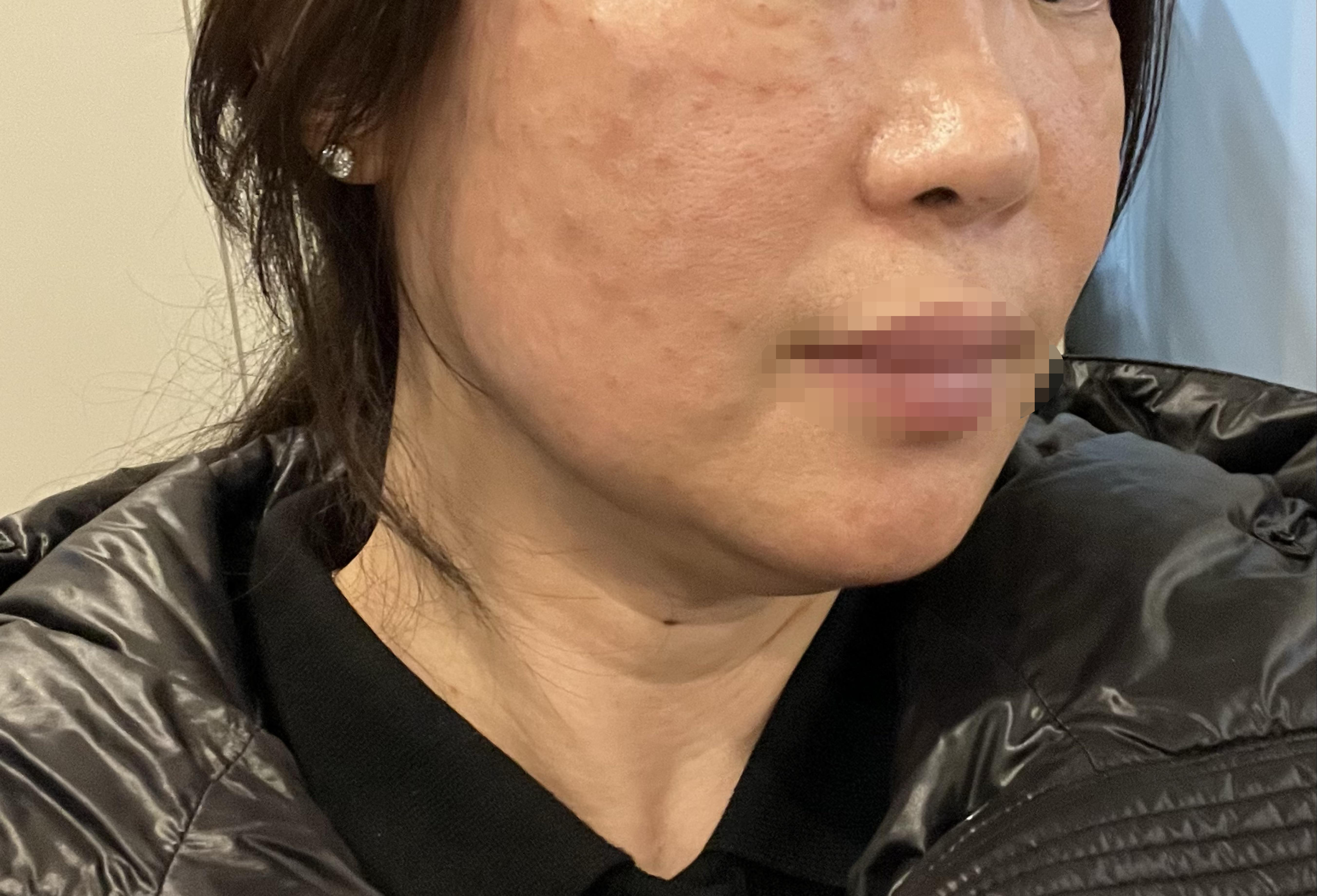 처음인데 효과 좋으면 꾸준히 받으려고 합니다~ 강남역과 가까워서 좋네요ㅎㅎ