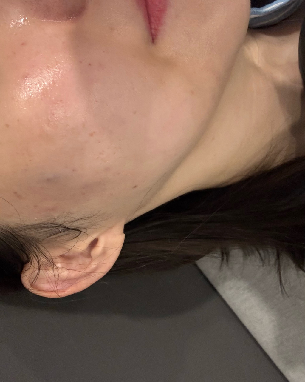 저번에 시술 한번에 받고 결과 보자마자 여기로 정착했어요~ㅎㅎ
