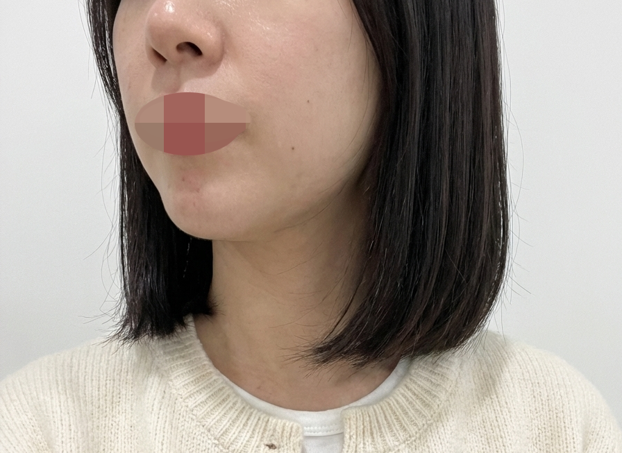 턱선 무너진 느낌이라 받았는데 부담 없이 편하게 받았어요!
