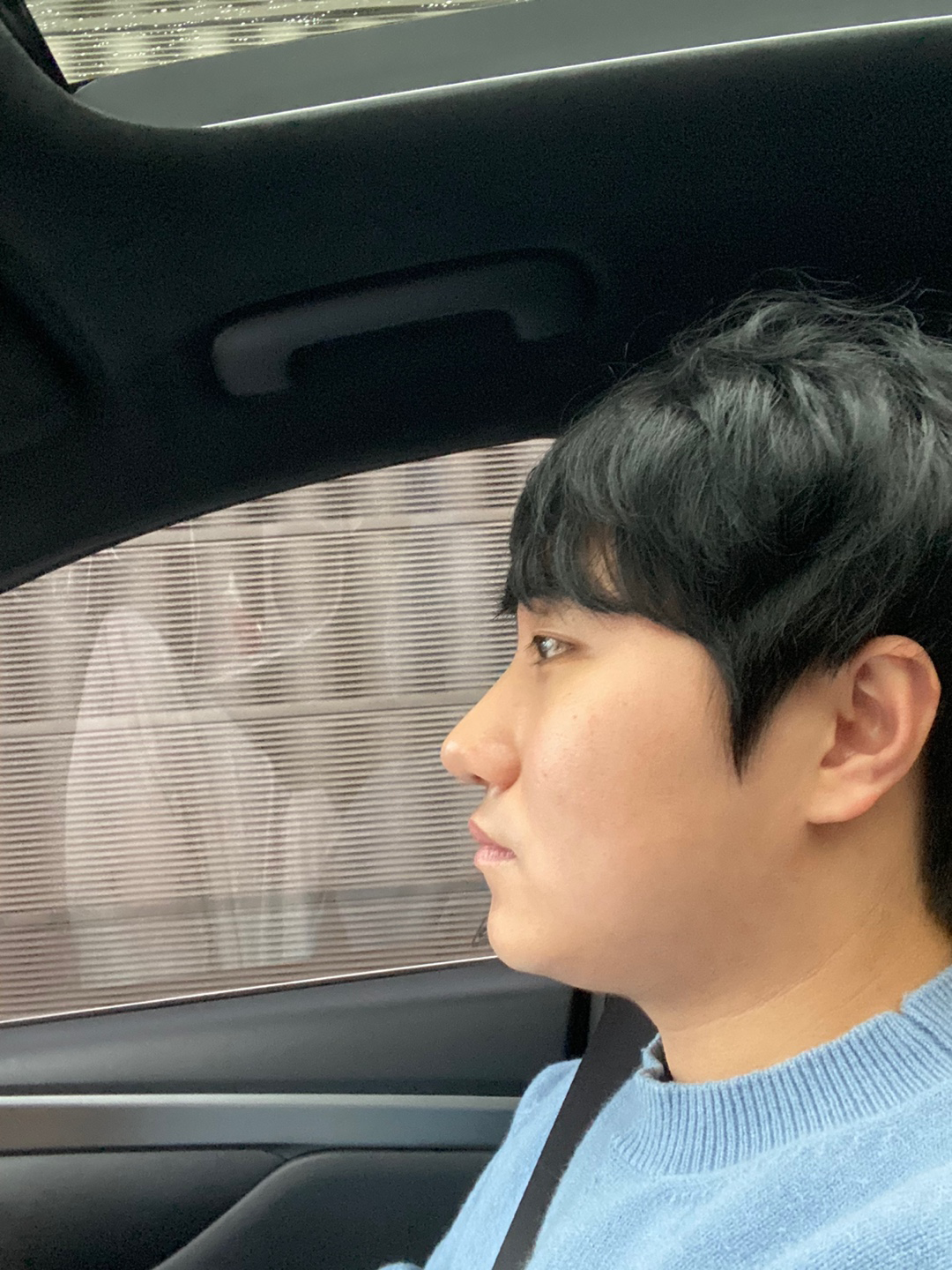 수술전보다 많이 좋아져서 만족합니다