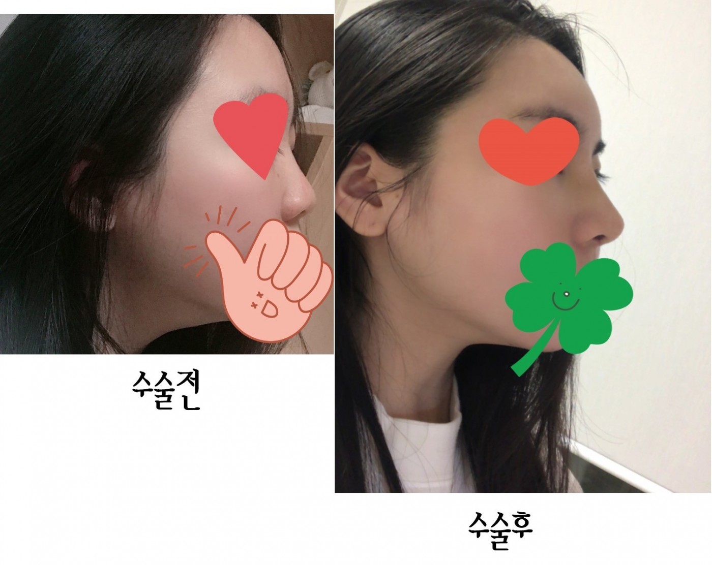 눈코지 9일차