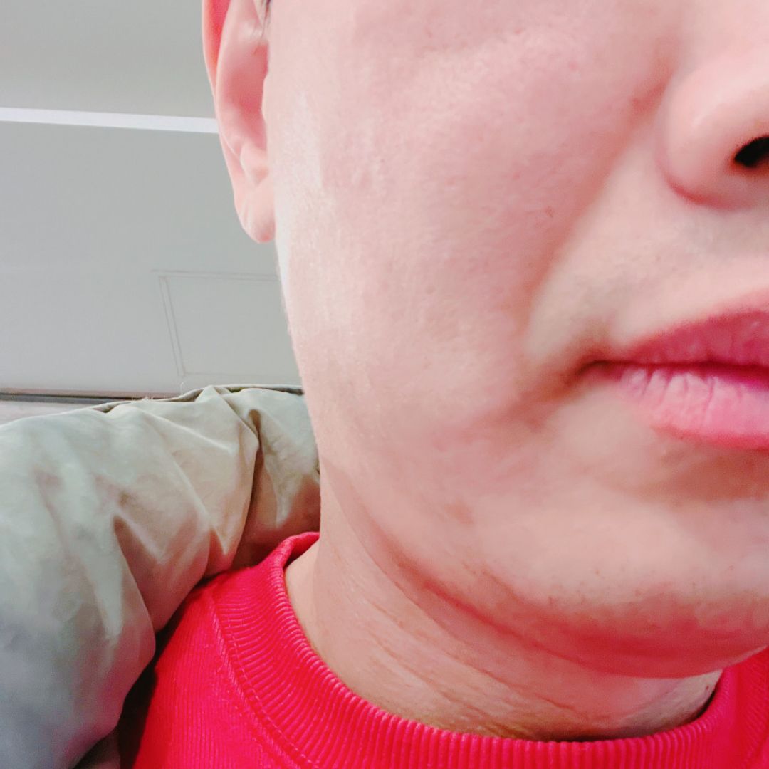 자도 피부 관리! 쥬베룩으로 탄력 채우는 중