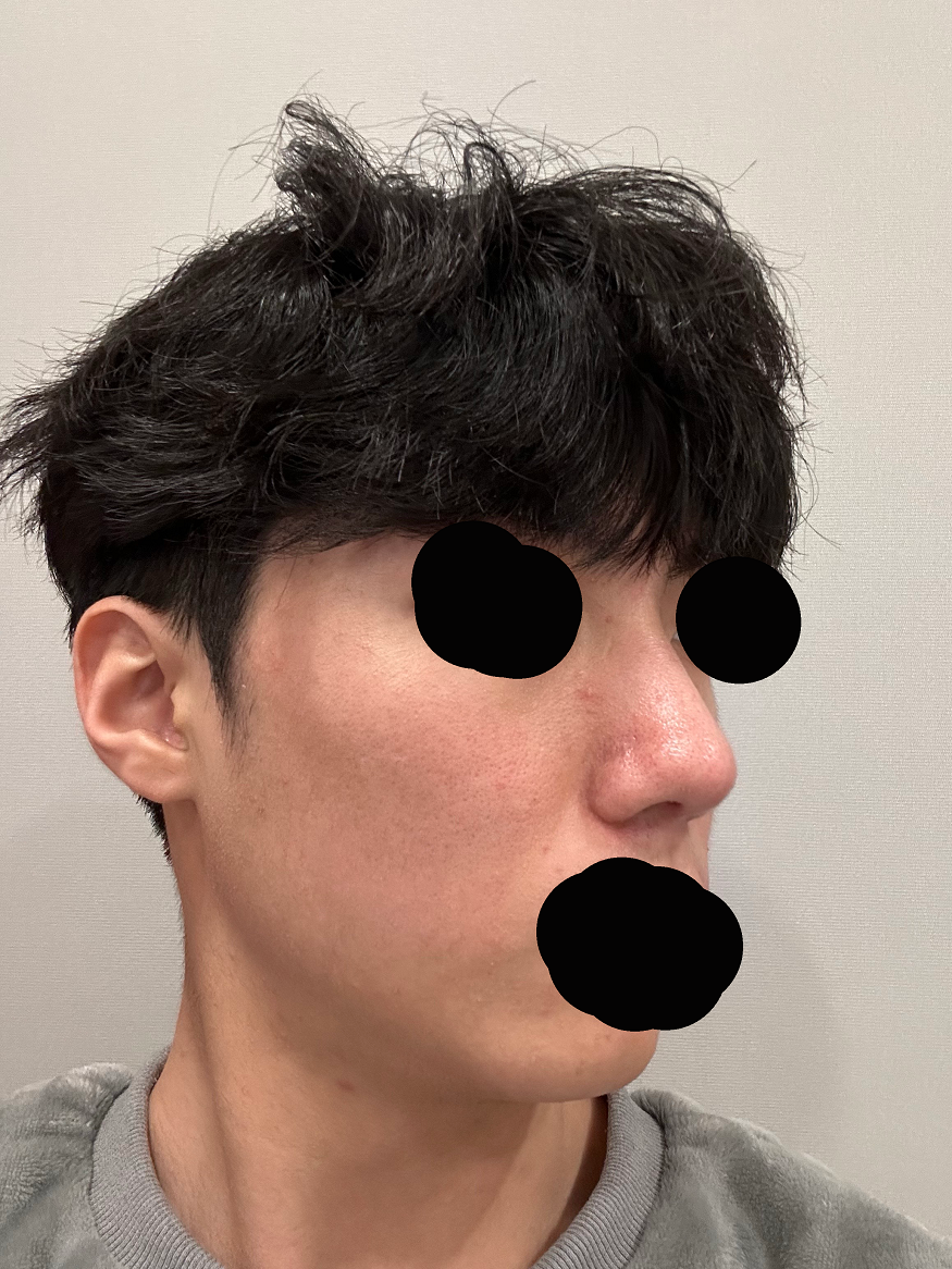 황원장님의 친절한상담과 수술로 만족합니다
