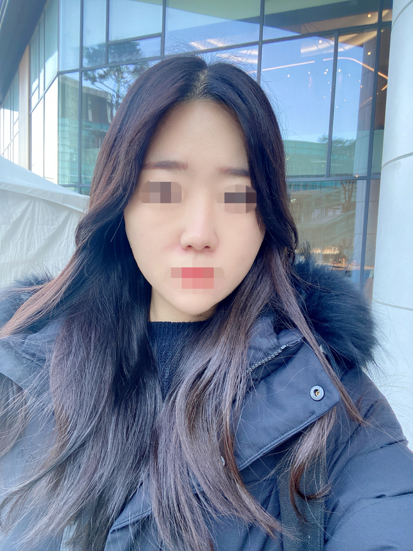 3개월차 되니까 점점 얇상해지고 자리를 잡아가는거같아요 ㅎㅎ