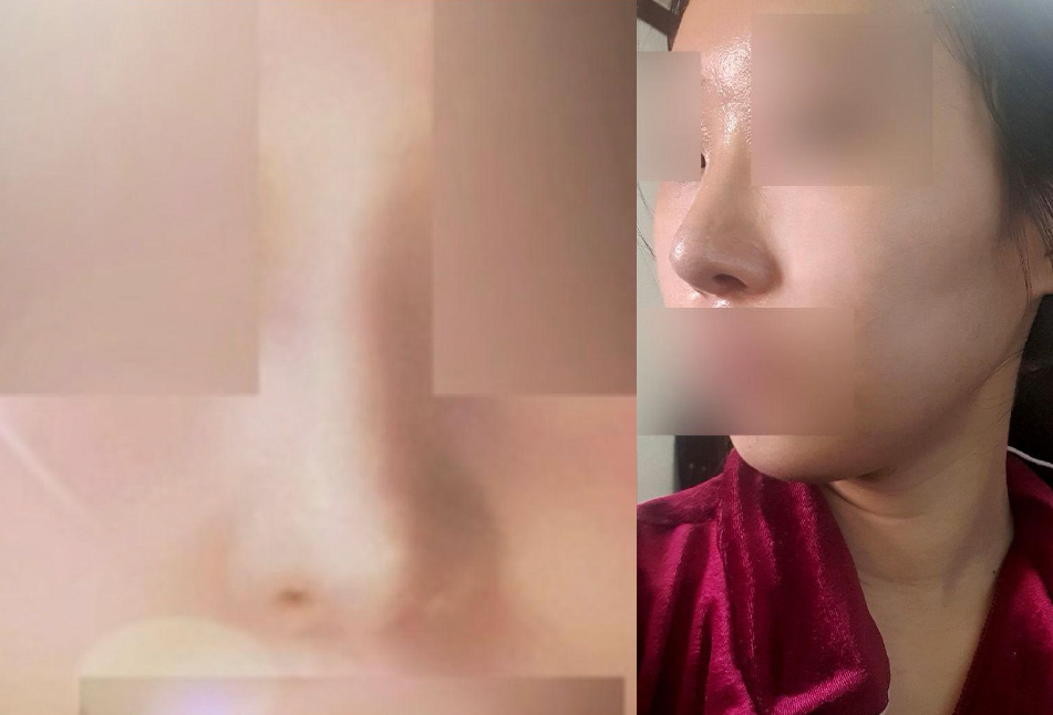 좋아용