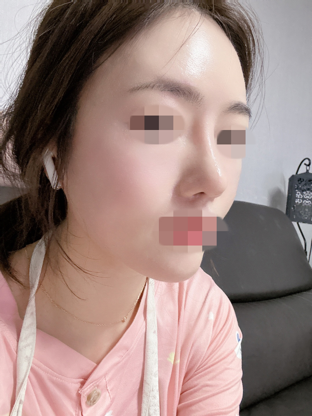 복코에서 이제 벗어난거같아서 하루하루 매일 행복해요~~
