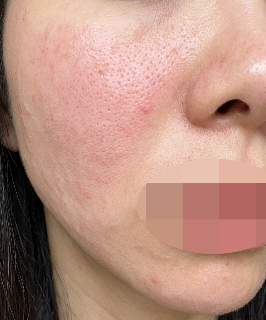 촘촘하게 잘 놔주시고, 대기 없이 빠른 진료 가능해서 좋네요~ㅎㅎ