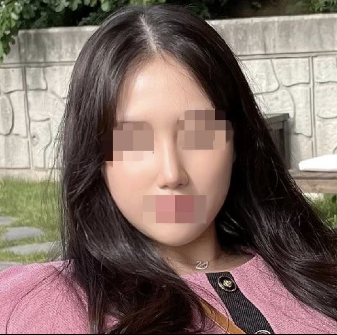 황정일 원장님 추천합니다 코수술하세영 !!!