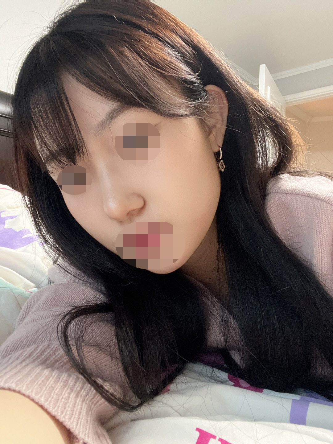 메부리인 라인이 메끄러워지고 코끝도 얄쌍하게 올라가서 만족해요
