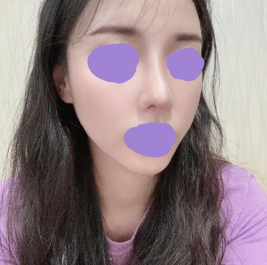 고민없이 GOGO!! 황원장님 감사합니다