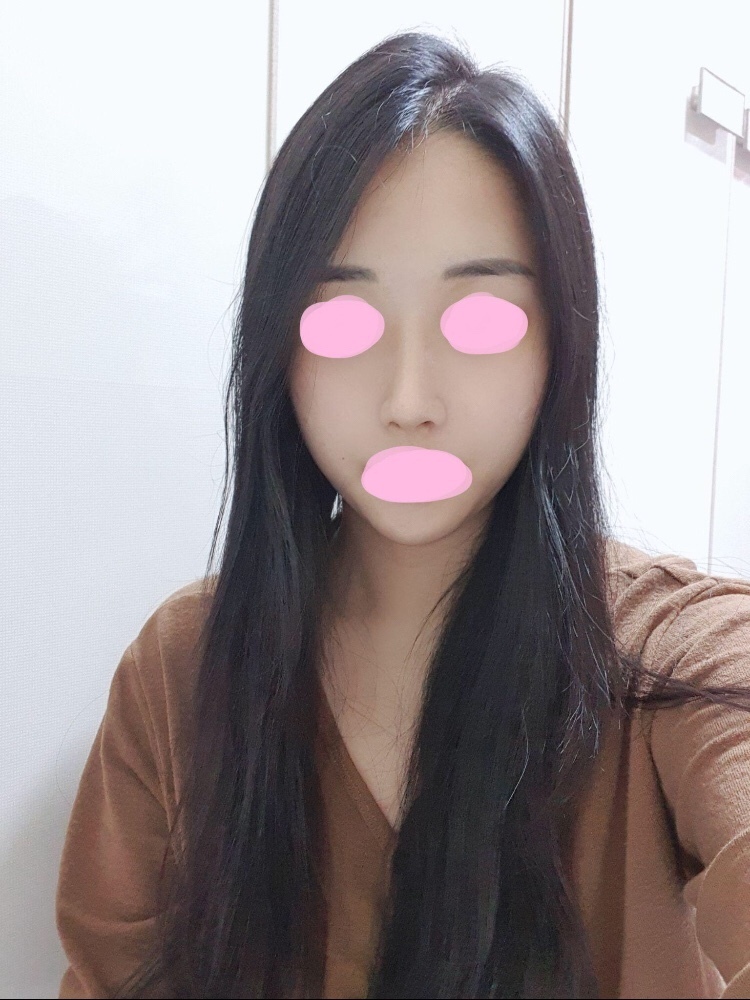코수술 3주차입니다