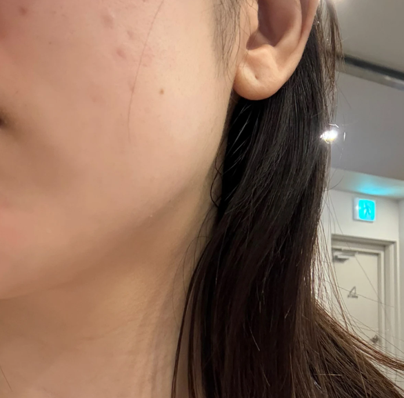 온다리프팅과 라리리쥬 받았는데 일본어 통역 있어서 최고예요 ㅎㅎ