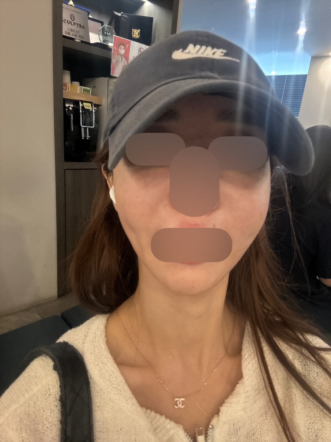 나이 들수록 꼭 받아야 할 스킨보톡스, 이번에도 만족이에요~