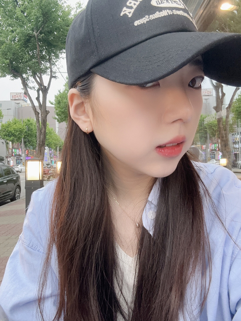 첫수술 및 성형이라 너무 걱정많았지만 코 높이 모양도 너무맘에들구 새삶을 사는중입니당