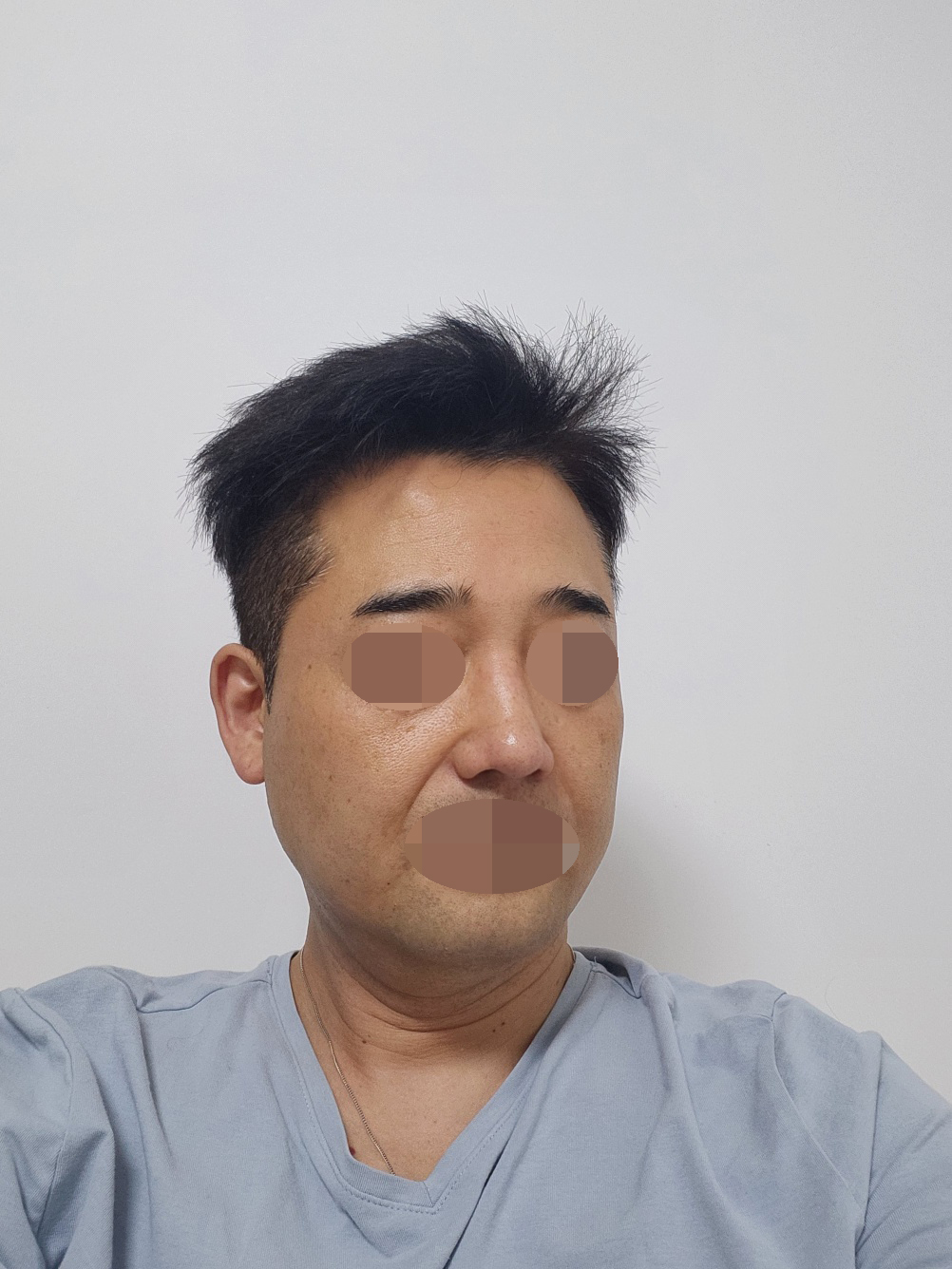 병원 위치도 좋아서 치료받거나 경과볼때 너무 좋아요. 코도 만족도 높구요