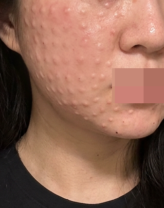 피부 탄력 고민에 받은 리쥬베룩, 일본어 응대까지 완벽했어요~!!