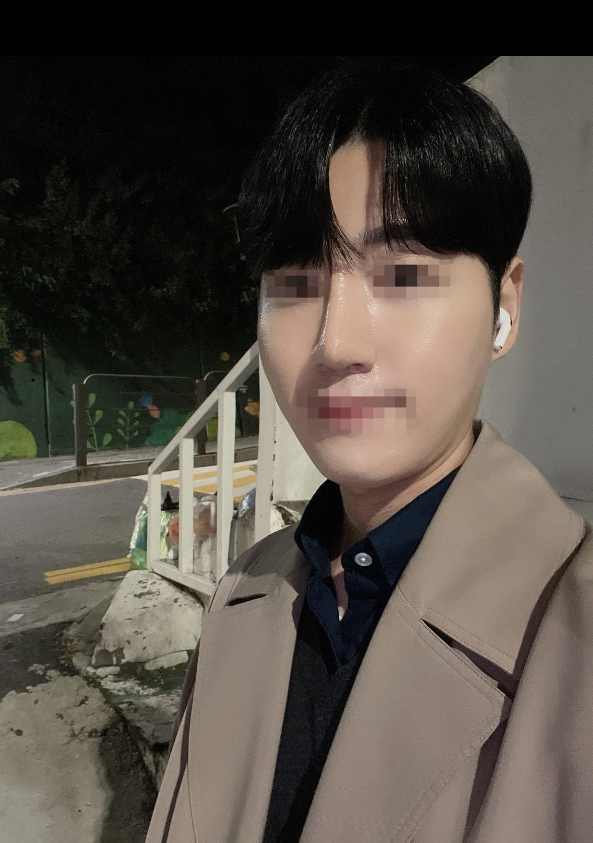 높아진 콧대 부러워하고 칭찬도 많이 받고 있어요.
