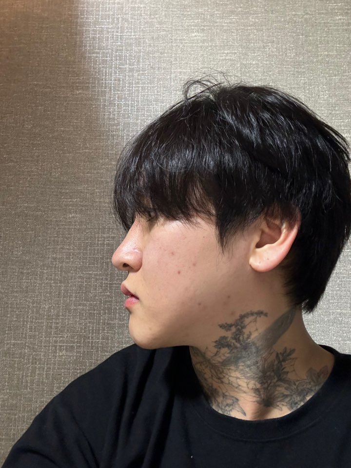 수술 이후 경과도 잘 봐주셔서 좋았어요.