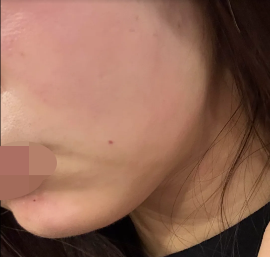 친절한 응대에 통증 없는 시술까지, 다시 한국 올 때 꼭 방문할 곳이에요~!