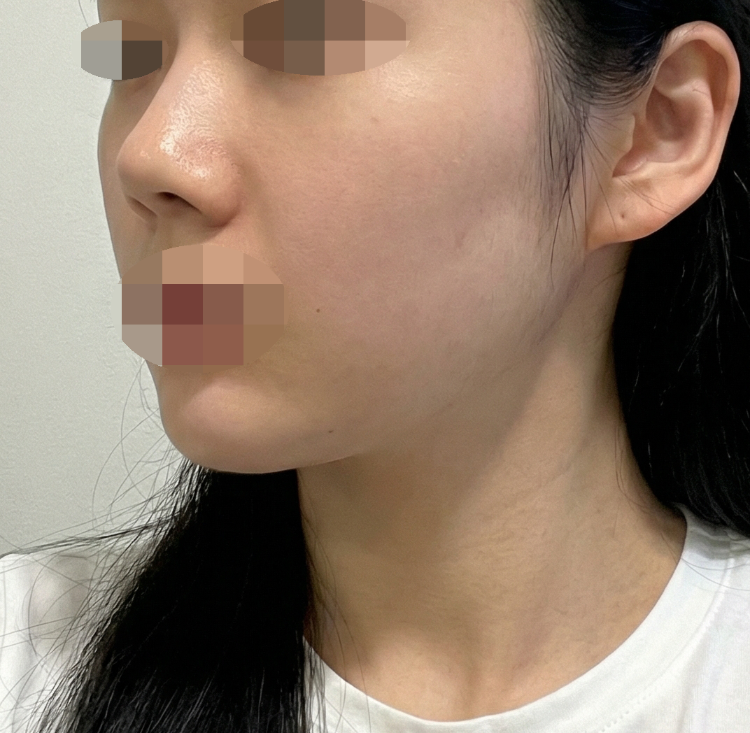 선생님들 다 친절하고 레디어스 효과도 바로 보여서 만족스러워요!!