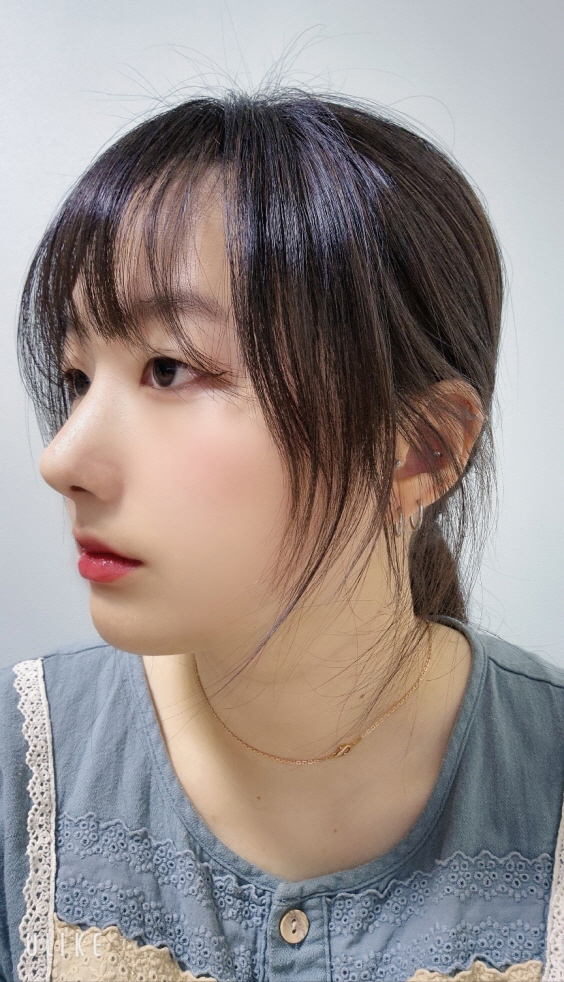 앞으로 붓기만 빠지면 저 예쁜 코가 될 것같아요!