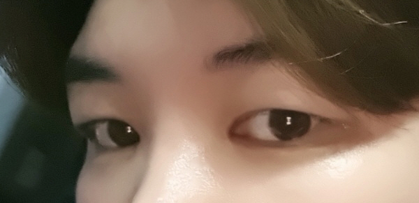 비용적인 부분, 상담실장님, 원장님 다 친절하고 좋았습니다