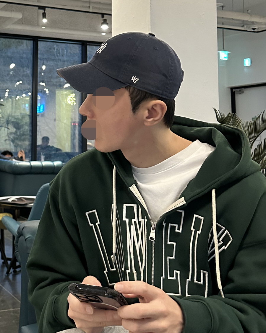 붓기가 빠지면 빠질수록 마음에 들어서 거울보는 맛에 지내요~