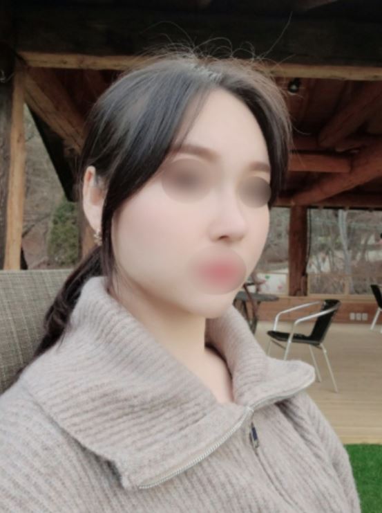 미용코+지흡+실리프팅 2달 후기