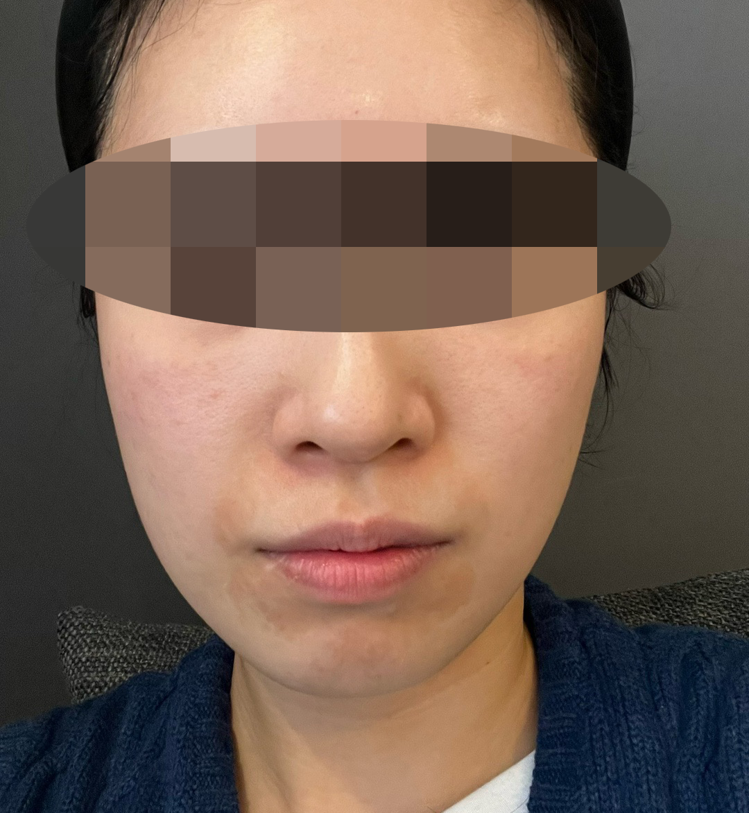 쥬베룩아이 3회 끊었는데 1회차부터 대박인 것 같아요ㅎㅎ