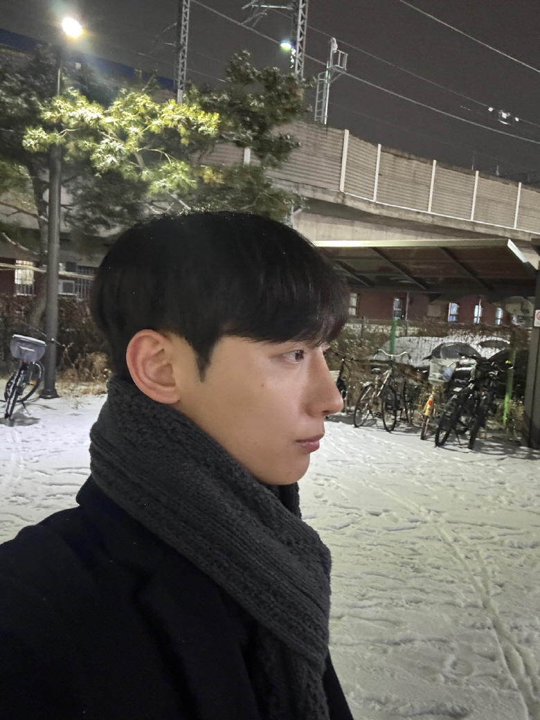 자연스럽고 너무 좋아요! 붓기가 줄면서 코끝이 얇상해지고 있어요