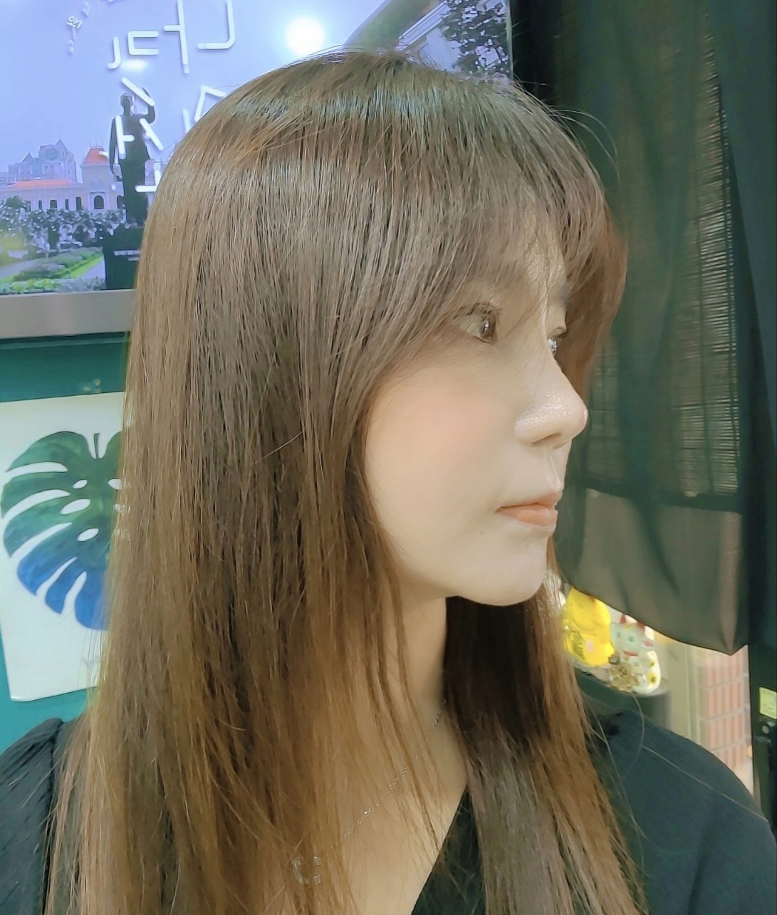 벌써 수술받은지 2달째 입니다^^붓기는 거의 빠졌고,점점 이쁘게 자리잡고 있어서 너무 만족합니다~