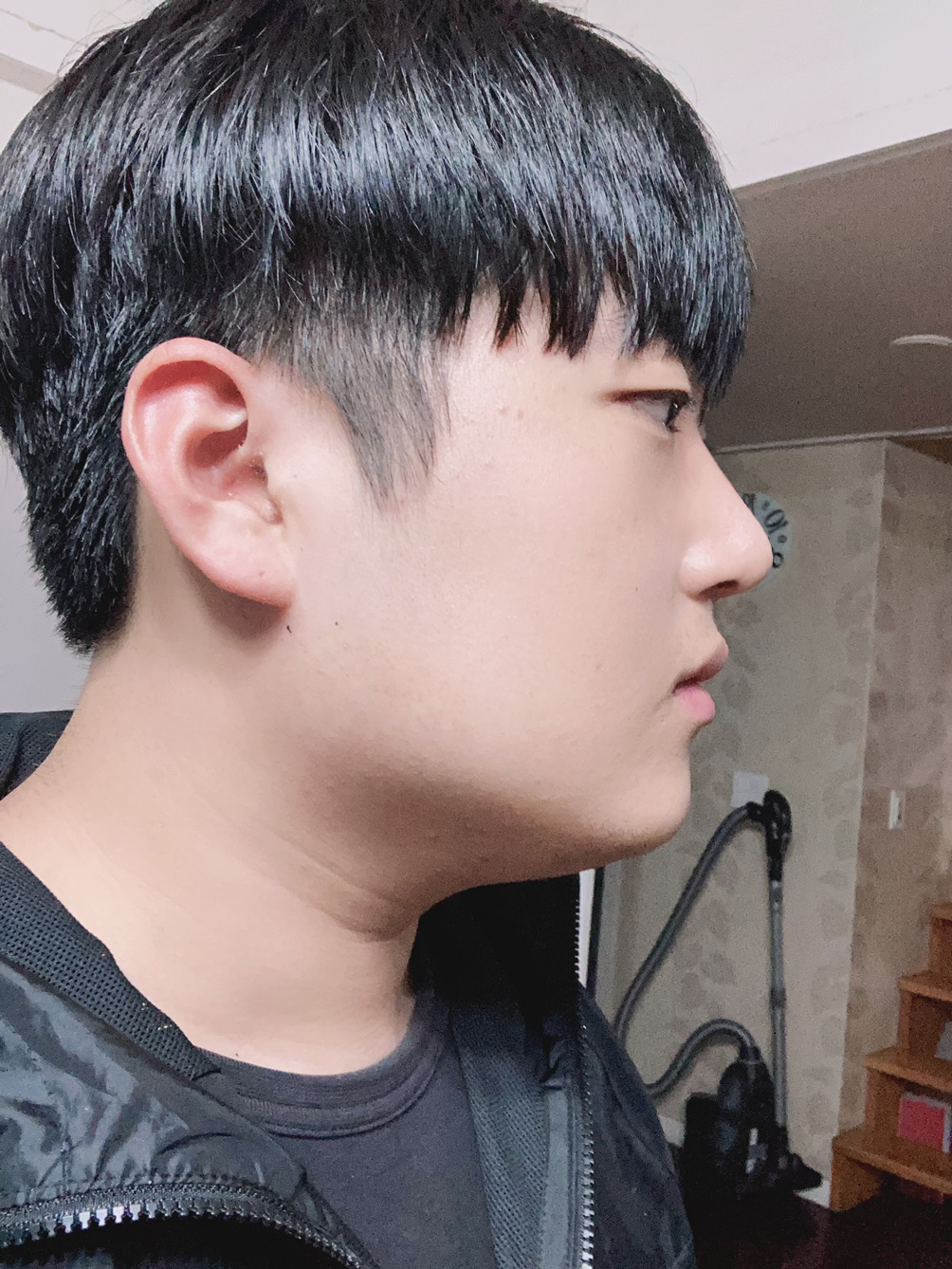 코도 이쁘게 자리잡았고 콧대도 올라가서 매우 좋습니다!