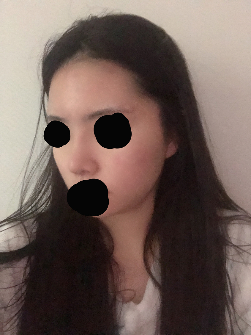 라인이 점점 보이는 거 같아요 만족합니당!!