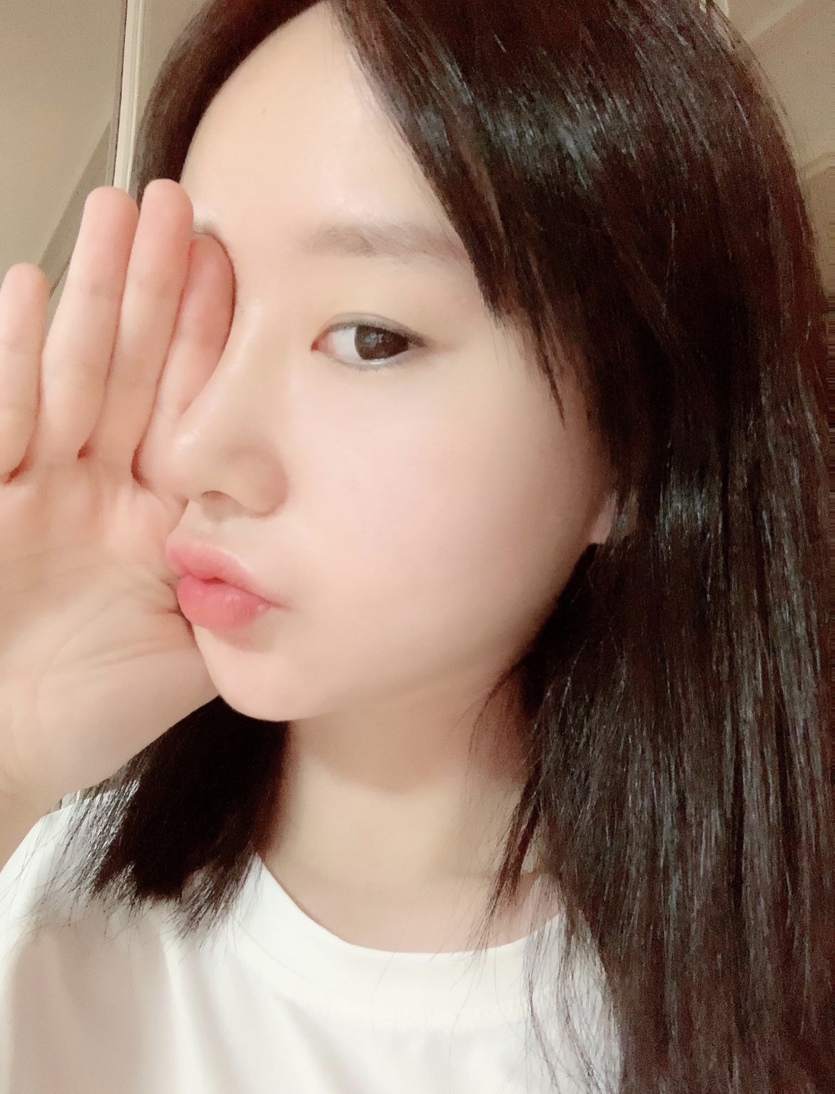 코끝수술 받은지 1주차에요