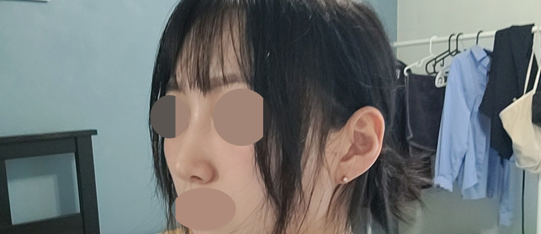 결과가 매우 만족스러워 추천하고 싶습니다!!