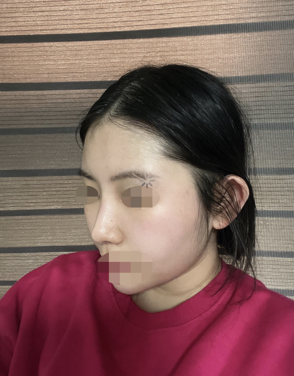 코 모양이나 높이나 제 얼굴에 맞게 예쁘게 되서 너무 만족중입니다 !