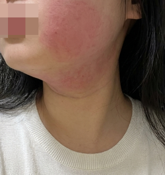 꼼꼼한 상담에 편안한 시술까지, 인모드 받기 잘했어요~