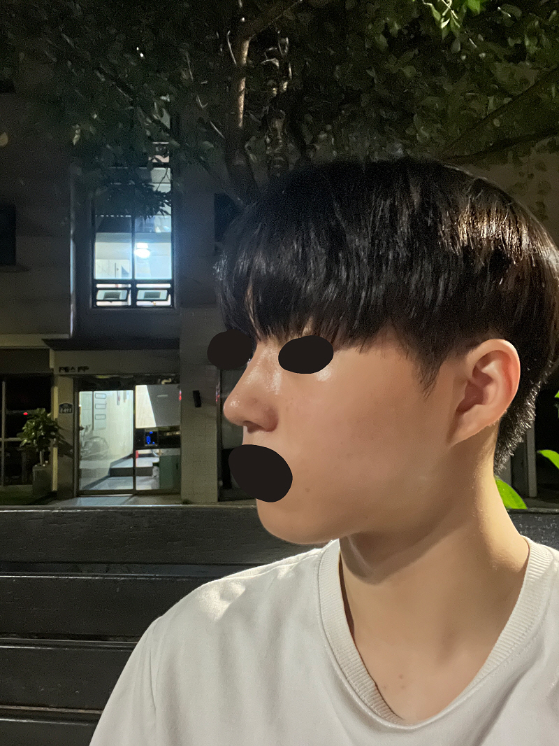 진짜 안한거 같이 자연스럽다는 말을 엄청 들었습니다! 티 나는게 너무 싫었는데 너무 맘에 들어요!