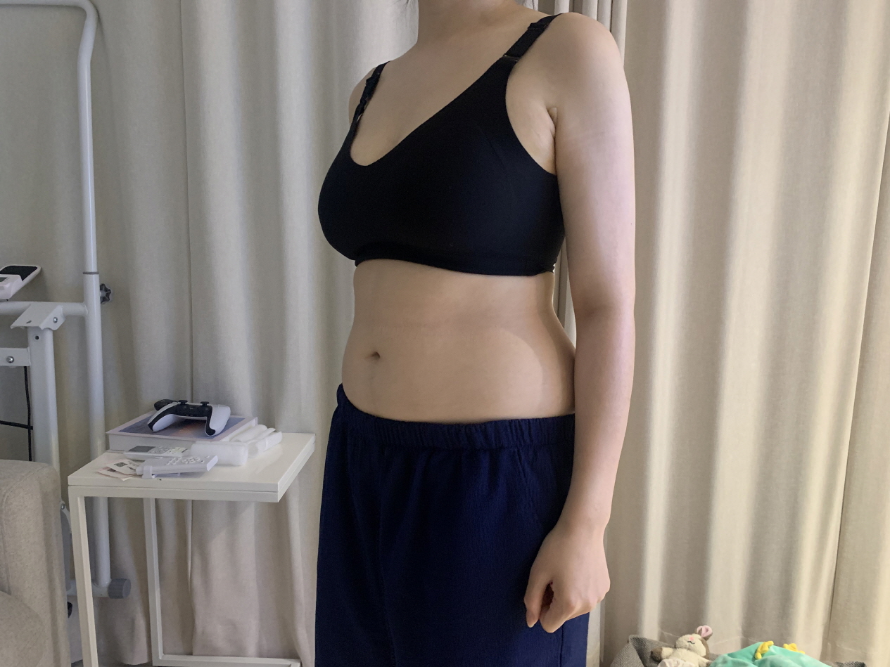 아직 붓기가 다 빠지지도 않았지만 라인이 너무 마음에 들고 붓기 다 빠졌을 때가 기대돼요!