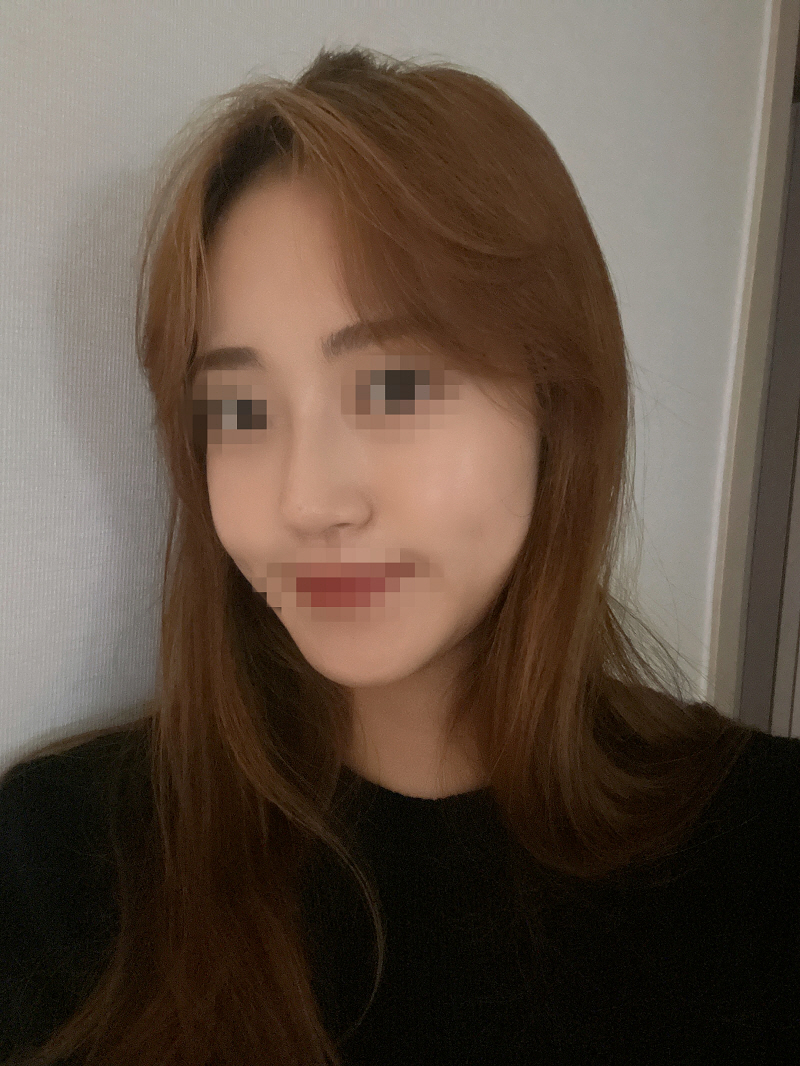 서울아이성형외과 황정일원장님 과하지않고 자연스럽게 잘해주시는거같아요 실력최고