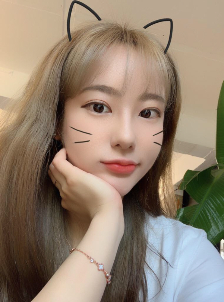 쌍꺼풀 매몰 후기예요