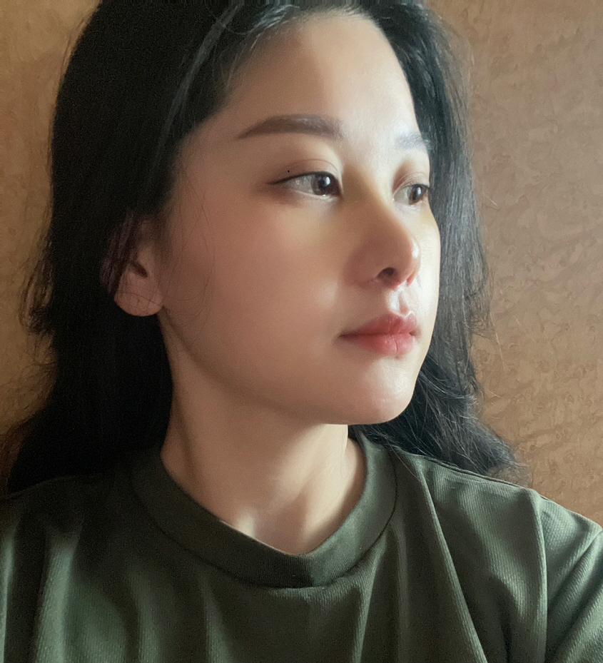 원장님의 노련함과 자연스러움을 추구하신 덕분에 결과는 대만족!!
